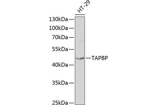 TAPBP 抗体  (AA 30-260)