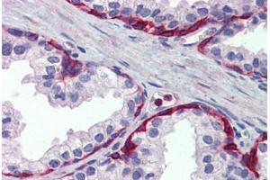 Human Prostate: Formalin-Fixed, Paraffin-Embedded (FFPE) (METTL7A antibody  (Internal Region))
