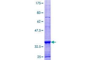 ARHGEF18 Protein (AA 1-89) (GST tag)