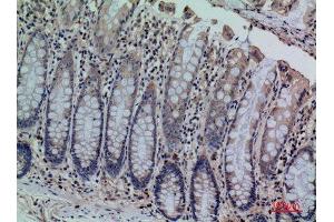 Immunohistochemistry (IHC) analysis of paraffin-embedded Human Colon, antibody was diluted at 1:100. (CDCP1 antibody  (Internal Region))