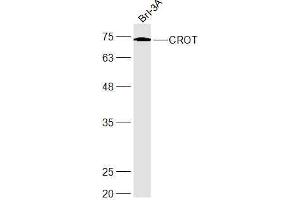 Brl-3A lysates probed with CROT Polyclonal Antibody, Unconjugated  at 1:300 dilution and 4˚C overnight incubation. (CROT antibody  (AA 201-275))