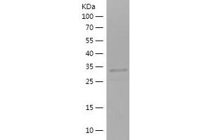 Western Blotting (WB) image for Solute Carrier Family 27 (Fatty Acid Transporter), Member 2 (SLC27A2) (AA 28-106) protein (His-IF2DI Tag) (ABIN7125161) (SLC27A2 Protein (AA 28-106) (His-IF2DI Tag))