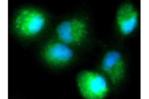 Immunofluorescence (IF) image for anti-Dual Specificity Phosphatase 18 (DUSP18) (AA 1-188) antibody (FITC) (ABIN5565391) (DUSP18 antibody  (AA 1-188) (FITC))