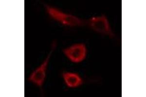 ABIN6274492 staining Hela cells by IF/ICC.