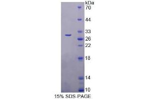 SDS-PAGE (SDS) image for Transmembrane Protein 173 (TMEM173) (AA 159-373) protein (His tag) (ABIN2127071)