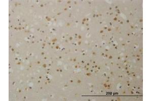 Image no. 1 for anti-Transducin (Beta)-Like 1X-Linked (TBL1X) (AA 478-578) antibody (ABIN598960) (TBL1X antibody  (AA 478-578))