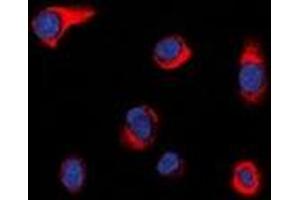 Immunofluorescent analysis of PIP5K staining in HepG2 cells. (PIKFYVE antibody  (N-Term))