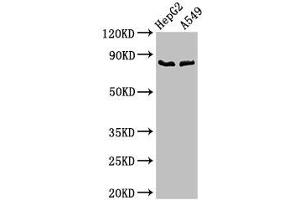 Western Blot Positive WB detected in: HepG2 whole cell lysate, A549 whole cell lysate All lanes: CFB antibody at 2. (Complement Factor B antibody  (AA 23-761))