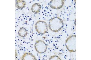 Immunohistochemistry (IHC) image for anti-Calcium Binding Protein 7 (CABP7) (AA 100-180) antibody (ABIN6137807)