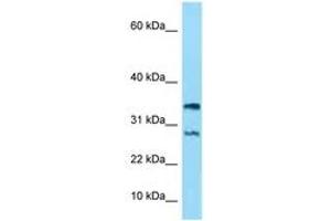 NDUFA11 anticorps  (AA 15-64)