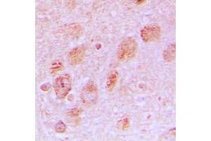 Immunohistochemical analysis of RPL17 staining in human brain formalin fixed paraffin embedded tissue section. (RPL17 antibody  (Center))