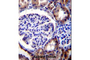 RICTOR Antibody (C-term) (ABIN391385 and ABIN2841393) immunohistochemistry analysis in formalin fixed and paraffin embedded human kidney tissue followed by peroxidase conjugation of the secondary antibody and DAB staining. (RICTOR antibody  (C-Term))