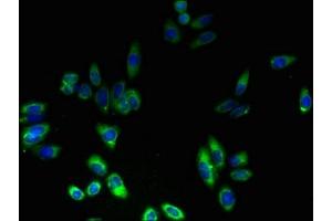 Immunofluorescence (IF) image for anti-Fibronectin Type III Domain Containing 3B (FNDC3B) (AA 5-71) antibody (ABIN7152887)