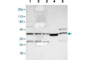 Western blot analysis of Lane 1: RT-4, Lane 2: U-251MG sp, Lane 3: A-431, Lane 4: Human liver, Lane 6: Human tonsil with LRG1 polyclonal antibody . (LRG1 antibody)