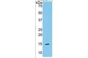 Western Blotting (WB) image for Serpin Peptidase Inhibitor, Clade G (C1 Inhibitor), Member 1 (SERPING1) ELISA Kit (ABIN6730925)