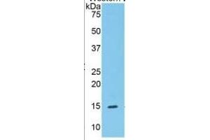 WB of Protein Standard: different control antibodies  against Highly purified E. (SERPING1 ELISA Kit)