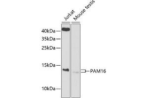 Western blot analysis of extracts of various cell lines, using P antibody (ABIN6133374, ABIN6145200, ABIN6145201 and ABIN6225214) at 1:1000 dilution. (MAGMAS antibody  (AA 21-125))