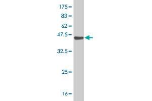 Western Blot detection against Immunogen (37. (CPSF2 antibody  (AA 683-782))