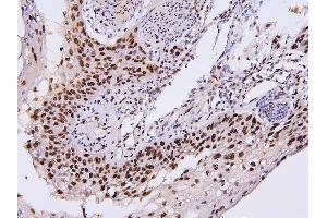 IHC analysis of PHF21A using anti-PHF21A antibody (ABIN6719353). (PHF21A antibody  (AA 1-97))