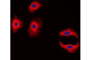 Immunofluorescent analysis of Claudin 3 staining in MCF7 cells.