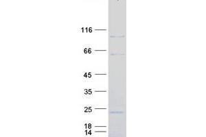 DAZ Interacting Protein 1-Like (DZIP1L) protein (Myc-DYKDDDDK Tag)