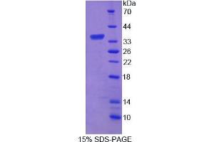 Image no. 1 for Amyloid beta (A4) Precursor Protein-Binding, Family B, Member 3 (APBB3) (AA 14-302) protein (His tag) (ABIN4989643)