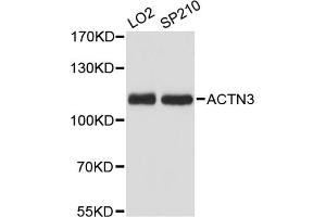Western blot analysis of extracts of various cell lines, using ACTN3 antibody (ABIN6290056) at 1:3000 dilution.