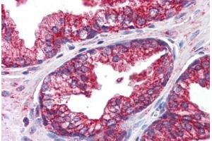 Human Prostate: Formalin-Fixed, Paraffin-Embedded (FFPE) (OCIAD1 antibody  (C-Term))