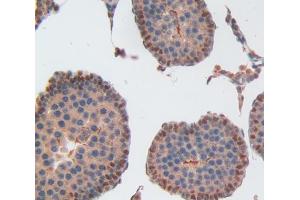 Used in DAB staining on fromalin fixed paraffin- embedded Kidney tissue (USP1 antibody  (AA 1-198))