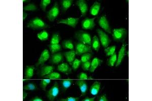 Immunofluorescence analysis of HeLa cells using RAN Polyclonal Antibody (RAN antibody)