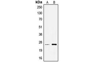 Western blot analysis of TCEAL6 expression in A549 (A), Jurkat (B) whole cell lysates. (TCEAL6 antibody  (Center))