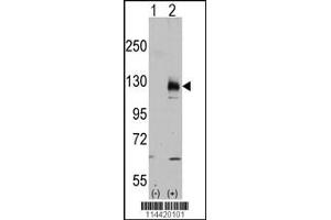 Western blot analysis of TRPM8 using rabbit polyclonal. (TRPM8 antibody  (C-Term))