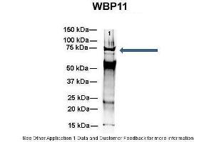Amount and Sample Type :  500 ug mouse brain homogenate  Amount of IP Antibody :  6 ug  Primary Antibody :  WB Primary Antibody Dilution :  1:500  Secondary Antibody :  Goat anti-rabbit Alexa-Fluor 594  Secondary Antibody Dilution :  1:5000  Gene Name :  WB Submitted by :  Dr. (WBP11 antibody  (N-Term))