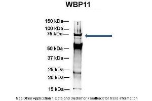 Amount and Sample Type :  500 ug mouse brain homogenate  Amount of IP Antibody :  6 ug  Primary Antibody :  WB Primary Antibody Dilution :  1:500  Secondary Antibody :  Goat anti-rabbit Alexa-Fluor 594  Secondary Antibody Dilution :  1:5000  Gene Name :  WB Submitted by :  Dr.