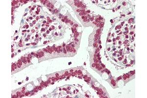 Human Small Intestine: Formalin-Fixed, Paraffin-Embedded (FFPE) (BTBD9 antibody  (AA 237-262))