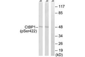 Western blot analysis of extracts from Jurkat cells treated with TNF 20ng/ml 30' and Jurkat cells treated with UV 15', using CtBP1 (Phospho-Ser422) Antibody. (CTBP1 antibody  (pSer422))