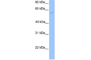 WB Suggested Anti-CCT6B Antibody Titration: 0. (CCT6B antibody  (N-Term))
