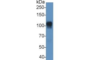 Detection of ATP1a1 in Mouse Heart lysate using Monoclonal Antibody to ATPase, Na+/K+ Transporting Alpha 1 Polypeptide (ATP1a1) (ATP1A1 antibody  (AA 493-660))