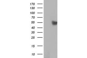 HEK293T cells were transfected with the pCMV6-ENTRY control (Left lane) or pCMV6-ENTRY RUVBL2 (Right lane) cDNA for 48 hrs and lysed. (RUVBL2 antibody  (AA 113-370))