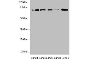Western blot All lanes: ZBTB48 antibody at 0. (ZBTB48 antibody  (AA 1-280))