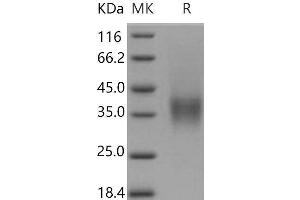 Western Blotting (WB) image for Low Affinity Immunoglobulin gamma Fc Region Receptor IV (FCGR4) (Active) protein (Biotin,His-Avi Tag) (ABIN7320420) (Low Affinity Immunoglobulin gamma Fc Region Receptor IV (FCGR4) (Active) protein (Biotin,His-Avi Tag))