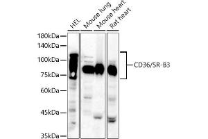 Western blot analysis of extracts of various cell lines, using CD36/SR-B3 antibody (ABIN6132248, ABIN6138173, ABIN6138174 and ABIN6221473) at 1:810 dilution. (CD36 antibody  (AA 30-270))