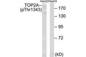 Western blot analysis of extracts from HepG2 cells treated with Ca2+ 40nM 30', using TOP2A (Phospho-Thr1343) Antibody. (Topoisomerase II alpha antibody  (pThr1343))