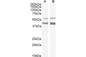 Western Blot using anti-CCR4 antibody KW-0761 (Mogamulizumab). (Recombinant CCR4 (Mogamulizumab Biosimilar) antibody)