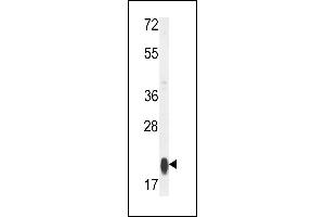 Western blot analysis of RT25 Antibody (C-term) (ABIN653808 and ABIN2843083) in MCF-7 cell line lysates (35 μg/lane). (MRPS25 antibody  (C-Term))