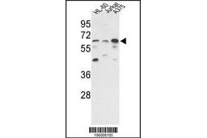 Western blot analysis of hPPP3CC-E33 in HL-60, Jurkat, A375 cell line lysates (35ug/lane) (PPP3CC antibody  (N-Term))
