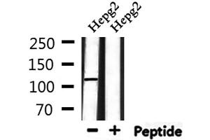 Western blot analysis of extracts from HepG2, using UBAP2L Antibody. (UBAP2L antibody  (Internal Region))
