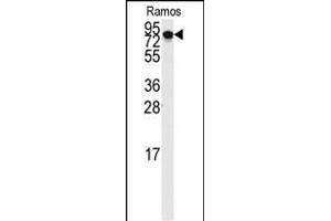 Western Blotting (WB) image for anti-Discs, Large (Drosophila) Homolog-Associated Protein 5 (DLGAP5) (AA 1-30), (N-Term) antibody (ABIN389311)