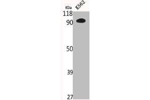 Western Blot analysis of K562 cells using N4BP1 Polyclonal Antibody (N4BP1 antibody  (Internal Region))