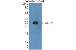 Detection of Recombinant XRN1, Rat using Polyclonal Antibody to 5'-3'Exoribonuclease 1 (XRN1) (XRN1 antibody  (AA 1567-1723))